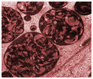 Electronmicrograph of lysosomes