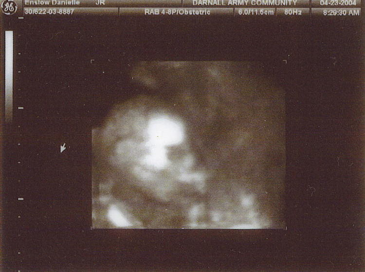 whats a sonogram whats a sonogram