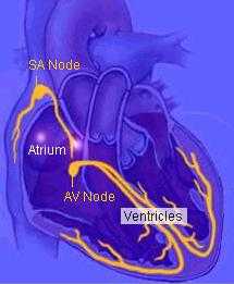 fibrila��oatrial.jpg (8719 bytes)