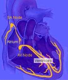 fibrila��oatrial1.jpg (8487 bytes)