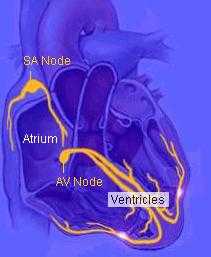 fibrila��oatrial2.jpg (8024 bytes)