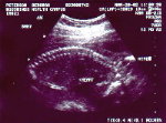 Here's the baby! (kinda floating on it's tummy)&nbsp; it's easy to make out it's spine in this one.&nbsp;&nbsp;&nbsp; CLICK TO SEE FULL SIZE