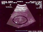 Here's a little baby footprint!&nbsp;&nbsp;&nbsp;&nbsp; CLICK TO SEE FULL SIZE