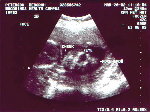 We were told you can see part of the baby's face in this one!&nbsp;&nbsp;&nbsp;&nbsp; CLICK TO SEE FULL SIZE