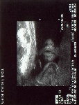 Here's a little baby nose and mouth.&nbsp;&nbsp;&nbsp;&nbsp;&nbsp;&nbsp;&nbsp;&nbsp;&nbsp; CLICK TO SEE FULL SIZE