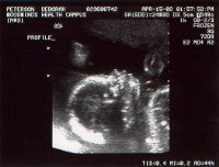 Our favorite baby picture so far.&nbsp; I think I almost see a little smile.&nbsp;&nbsp;&nbsp;&nbsp;&nbsp;&nbsp;&nbsp;&nbsp; CLICK TO SEE FULL SIZE