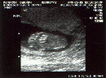 Here's a little baby footprint again...a little bigger now.&nbsp;&nbsp;&nbsp;&nbsp;&nbsp;&nbsp;&nbsp;&nbsp;&nbsp; CLICK TO SEE FULL SIZE