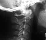 Region Cervical Normal