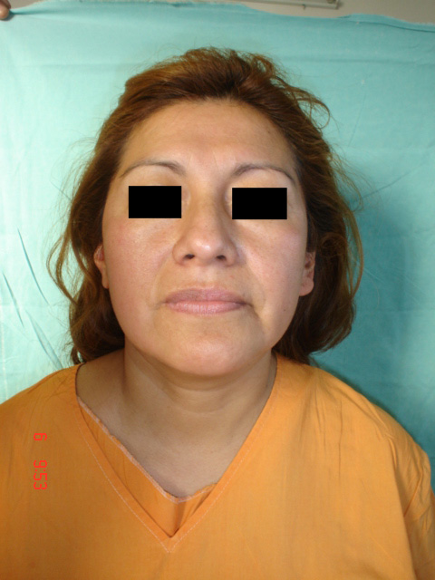 Fig. 6: Paciente femenino 