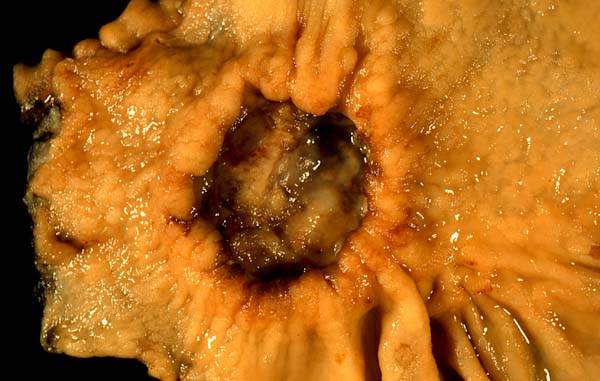 specimen
image