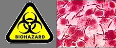 Biohazard: Virus Anthrax