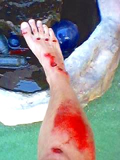 ouch!!