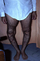 knees.jpg (14049 bytes)