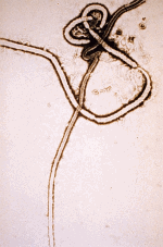 Ebola virus electronmicrograph (19830 bytes)