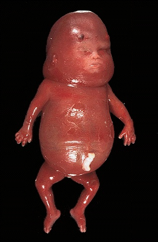 HOT TAMALES!!! Get your RED HOT fetus while ya CAN!!!