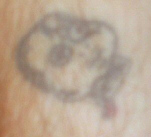 This is a very poor picture of the broken baby doll head that is located on my right forearm. This Tat is also dedicated to Jaroth, more specifically his death.