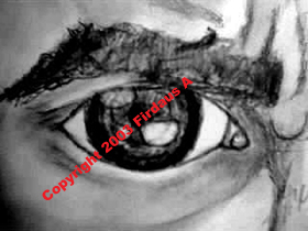 Worry