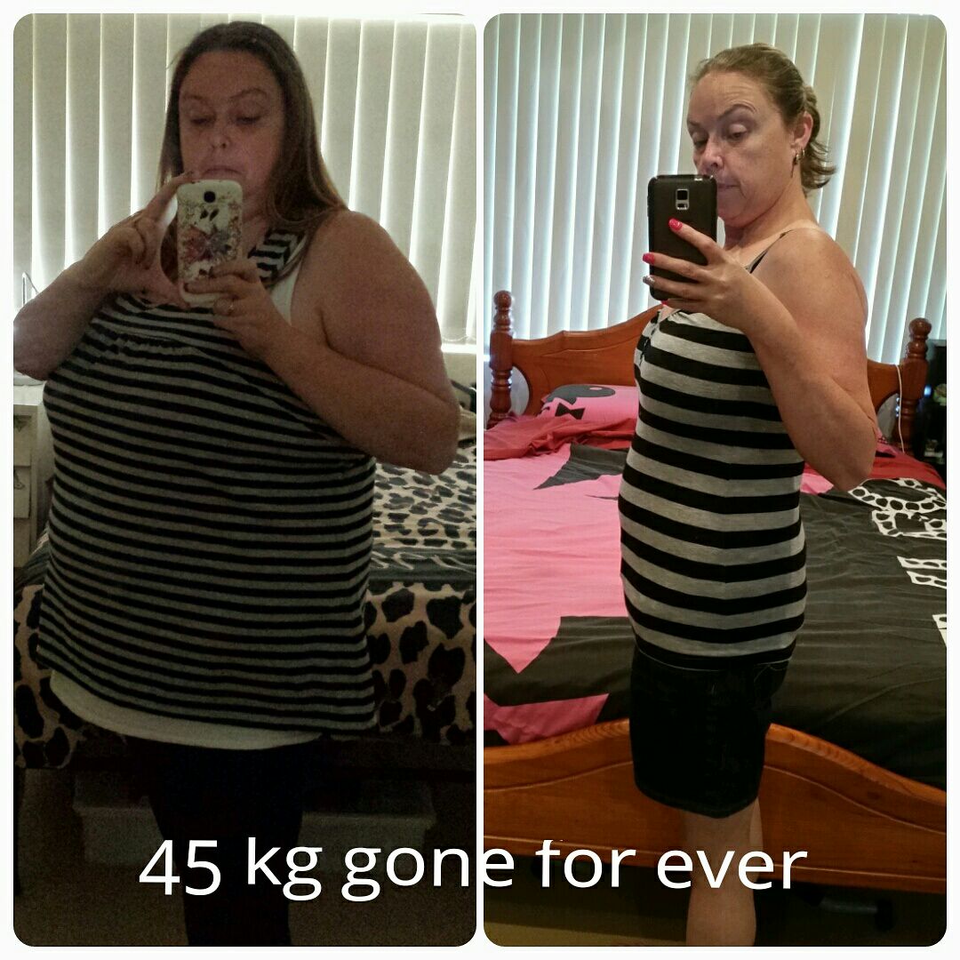 45KG
