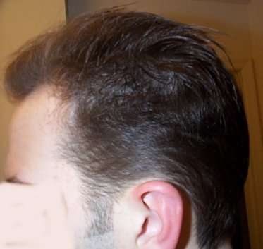 You call that a forehead?! That's a FiveHead!