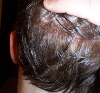 One month later ... Train tracks fading ...