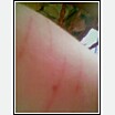 Upper left arm