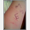 Lower left arm
