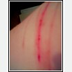 Upper right arm