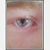 My eye! :)