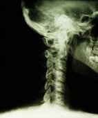 Columna Vertebral