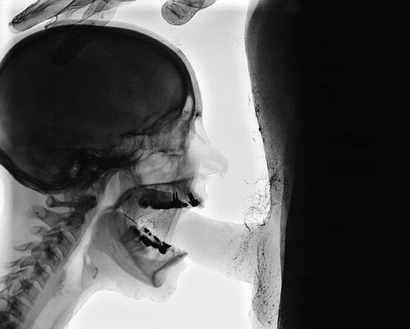 What an X-ray