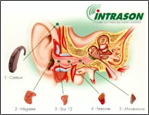 dispositivos intracanal y detr�s de la oreja