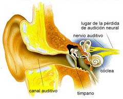 audicion_neural_020207