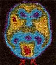 Imagen de tomograf�a computada del cerebro.