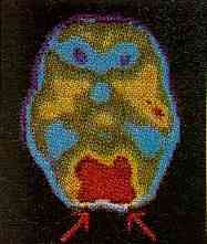 Imagen de tomograf�a computada del cerebro.