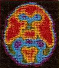 Imagen de tomograf�a computada del cerebro.