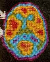 Imagen de tomograf�a computada del cerebro.