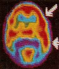 Imagen de tomograf�a computada del cerebro.