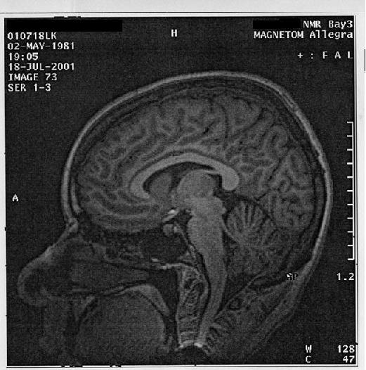 Brain.  Big file, sorry.  But this one's not copyright anyone.  Whahahahah!
