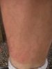 [ One of Gary's sun-burnt legs ]