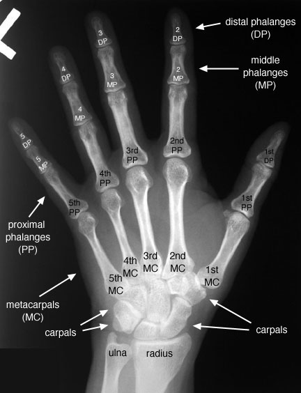 Hand & Wrist Injuries