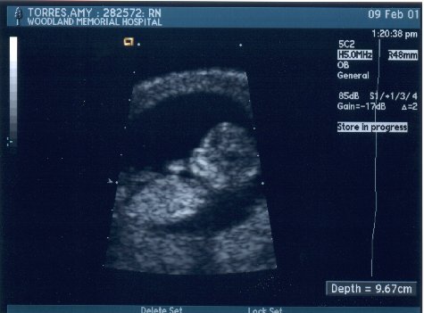 [Baby 1]