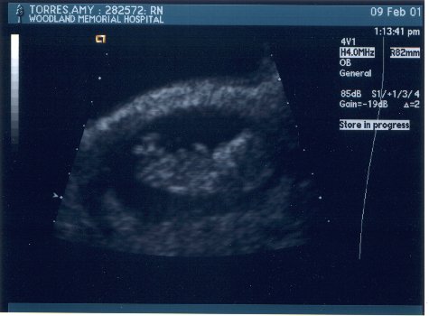 [Baby 2]
