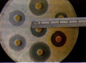 Antibio.jpg (22571 bytes)