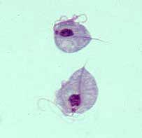 Trichomonas_Giemsa_DPDx.jpg (2433 bytes)