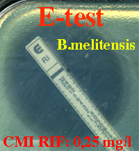 br26-etest.jpg (32557 bytes)