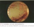 candidagar1.jpg (3525 bytes)