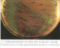 chromogenicecoli1.jpg (4324 bytes)