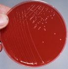 gammahemol-72.jpg (5812 bytes)