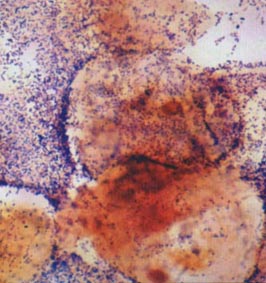 Flagyl e candida - Amoxil uti dose Flagyl e candida - Amoxil uti dose