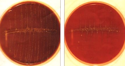 haemophilus1.jpg (14448 bytes)